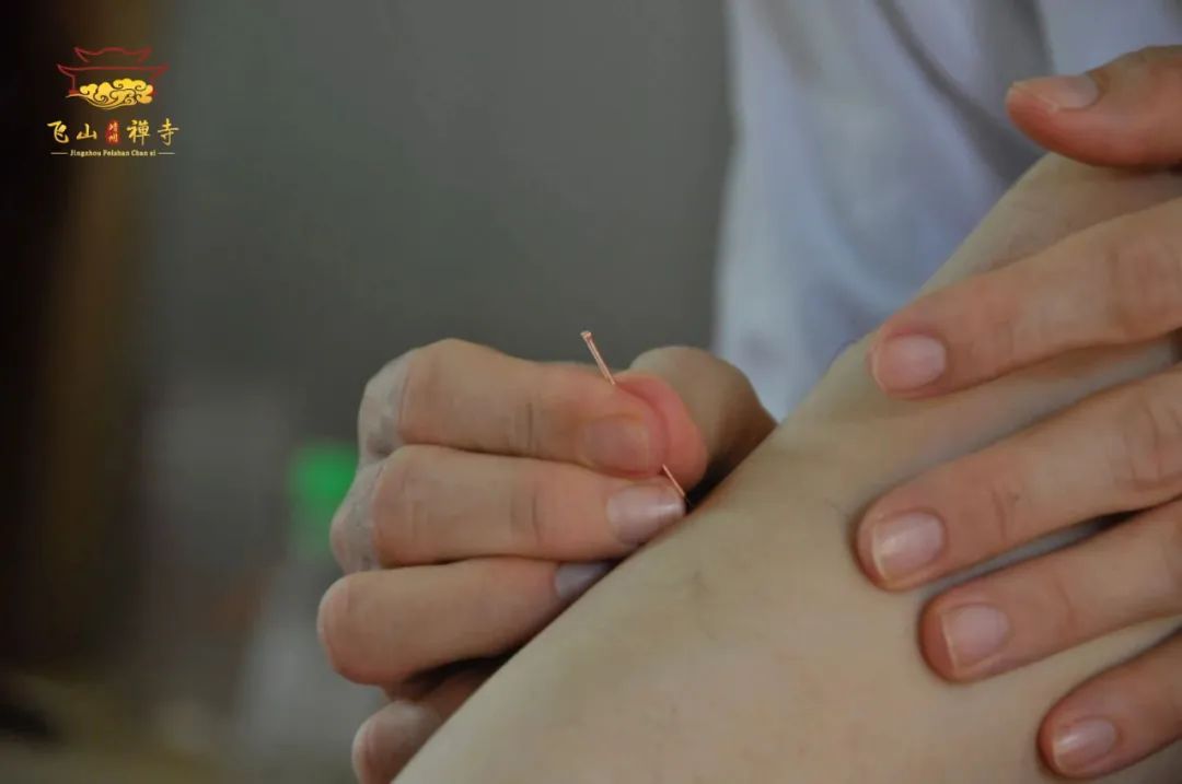禅修丨湖南飞山禅寺2021年国庆内观禅+针灸前行禅班开始报名